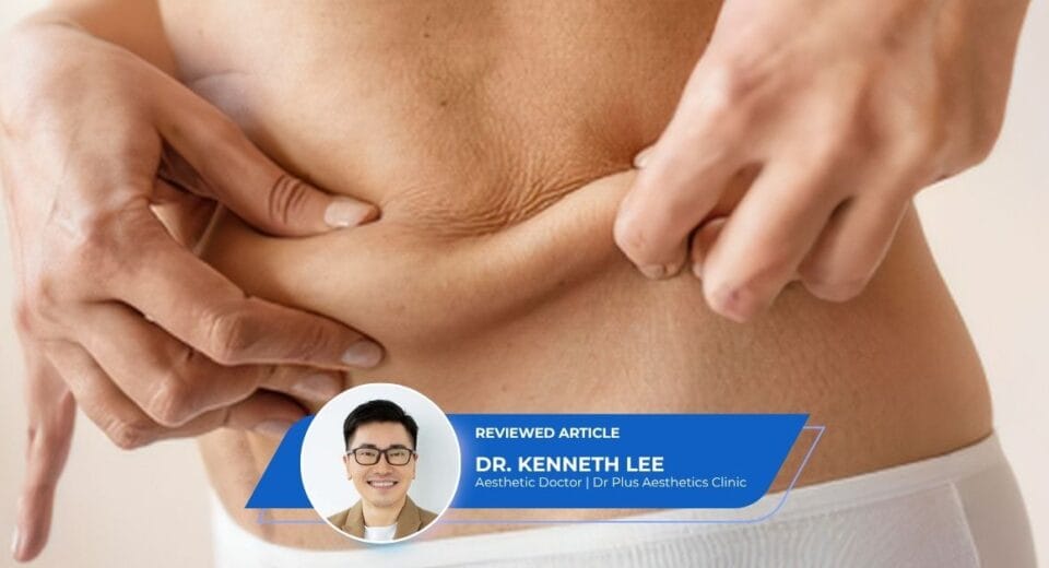 Loose Belly Skin After Pregnancy - Dr Kenneth Lee