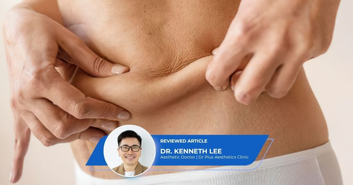 Loose Belly Skin After Pregnancy - Dr Kenneth Lee