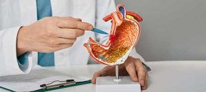 gastric-colon