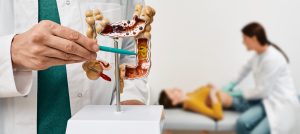 Understanding Colorectal Cancer: Symptoms, Risk Factors, and Prevention